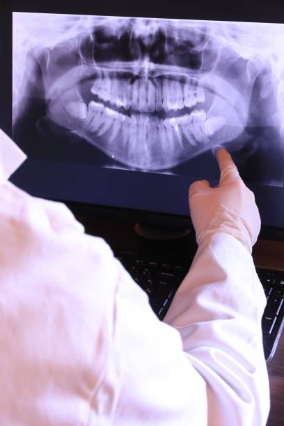 Best Emergency Treatment for Toothache in Lumber City, GA